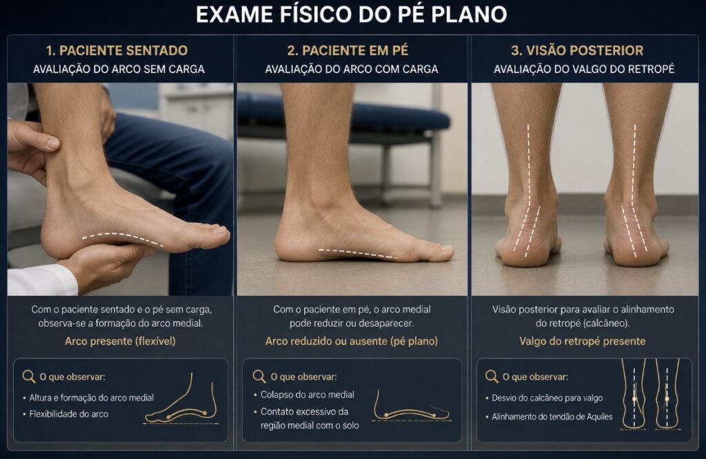Sequência de fotos demonstrando o exame físico: paciente sentado (avaliação do arco sem carga),
paciente em pé (avaliação do arco com carga), visão posterior (avaliação do valgo do retropé).
